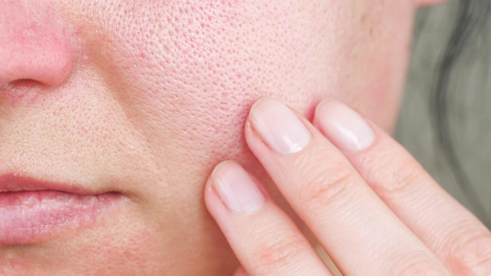 Causes of Dry Skin from Oxygen Therapy